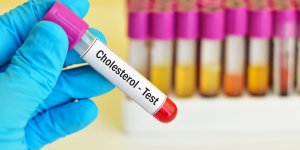 Bilan lipidique : focus sur le cholesterol LDL