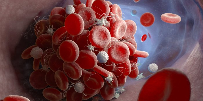 Caillot : 7 signes qui doivent alerter apres le vaccin JohnsonJohnson