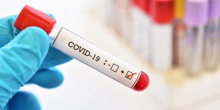 COVID-19 : les 10 departements ou les admissions a l-hopital ont grimpe cette semaine