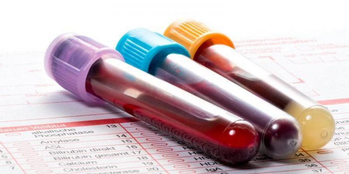 Don de sang : quelles sont les contre-indications ?