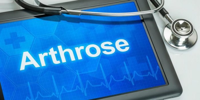 Arthrose : 6 actions a mener pour mieux vivre avec la maladie