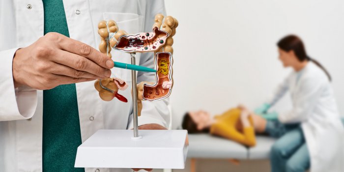 Cancer colorectal : devez-vous realiser un depistage ?