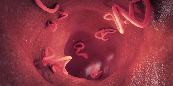 Ces symptomes qui montrent que vous avez des parasites intestinaux