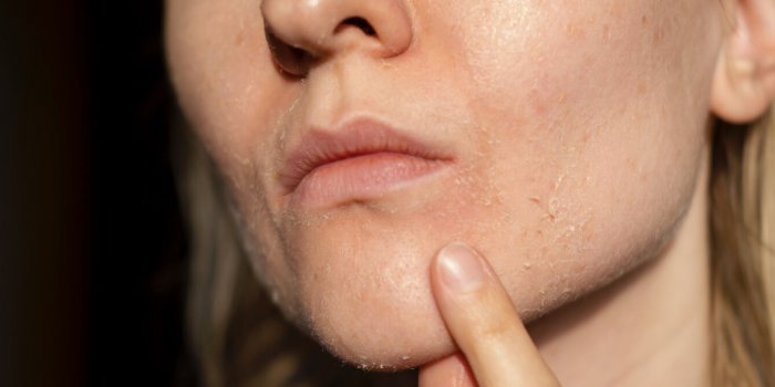 Ce que votre visage dit de vous (hormone et carence)