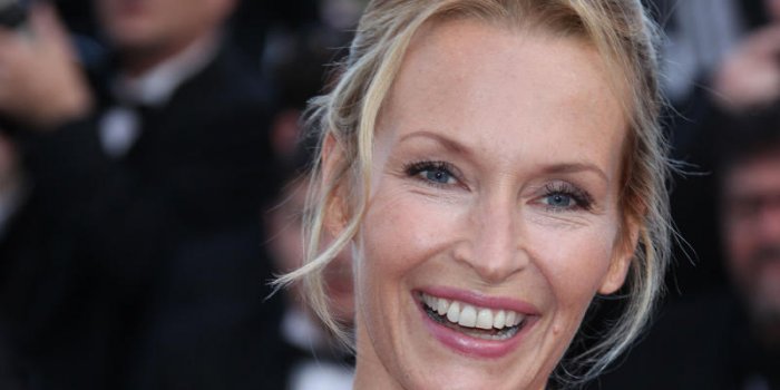 Botox : Estelle Lefebure evoque son recours a la chirurgie esthetique