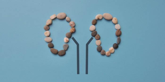 Calcul renal : les symptomes d-alerte a prendre au serieux