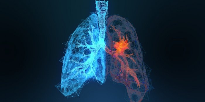 Cancer du poumon : 6 sensations corporelles qui doivent alerter