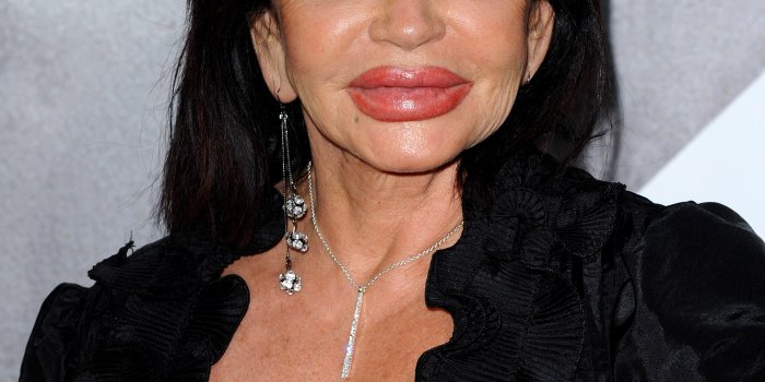 Les rates de la chirurgie esthetique