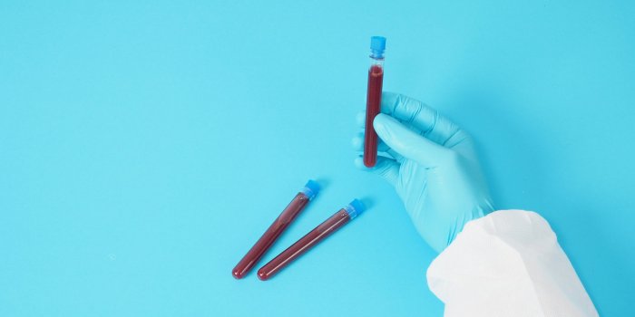 Triglycerides : 7 signes qui prouvent qu-elles sont trop elevees