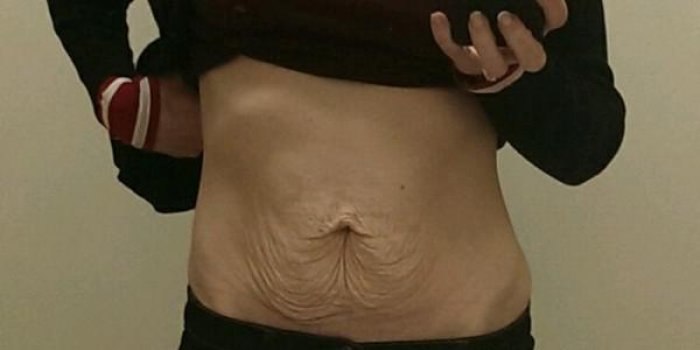 Fiere, elle montre son ventre apres la grossesse de ses jumeaux