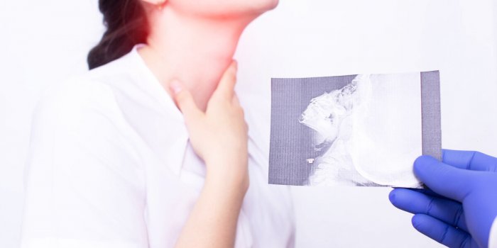 Cancer du cou : ces 5 signes doivent vous alerter