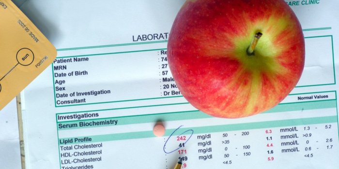 Cholesterol : 9 zones du corps qui peuvent devenir douloureuses