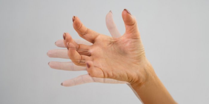 Parkinson : 5 facteurs de risque ont ete decouverts par une etude